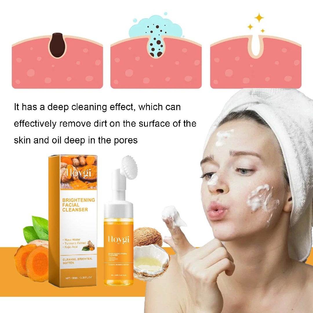 Hoygi Soin anti-taches acné naturel éclat et douceur - Bien-être & style 