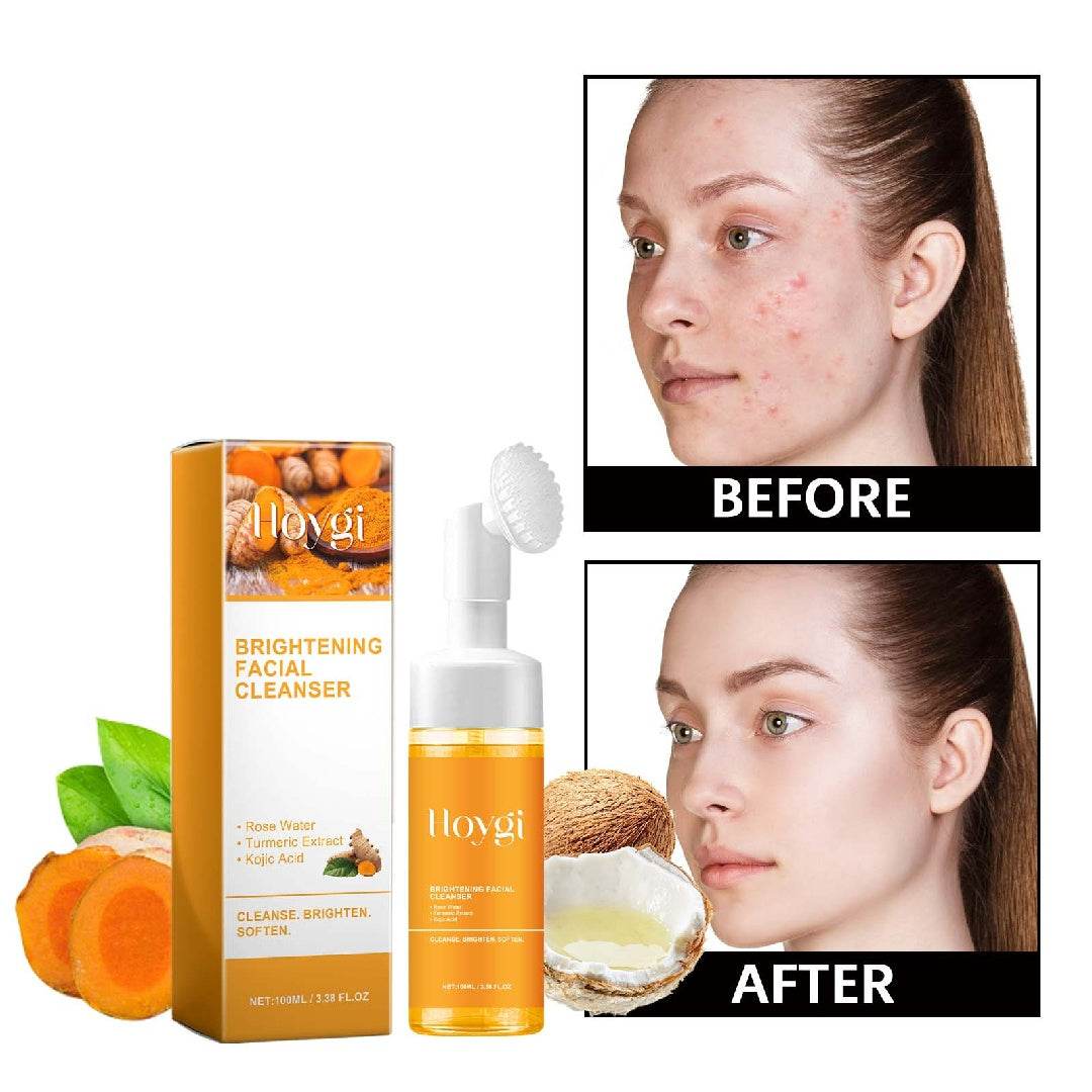Hoygi Soin anti-taches acné naturel éclat et douceur - Bien-être & style 