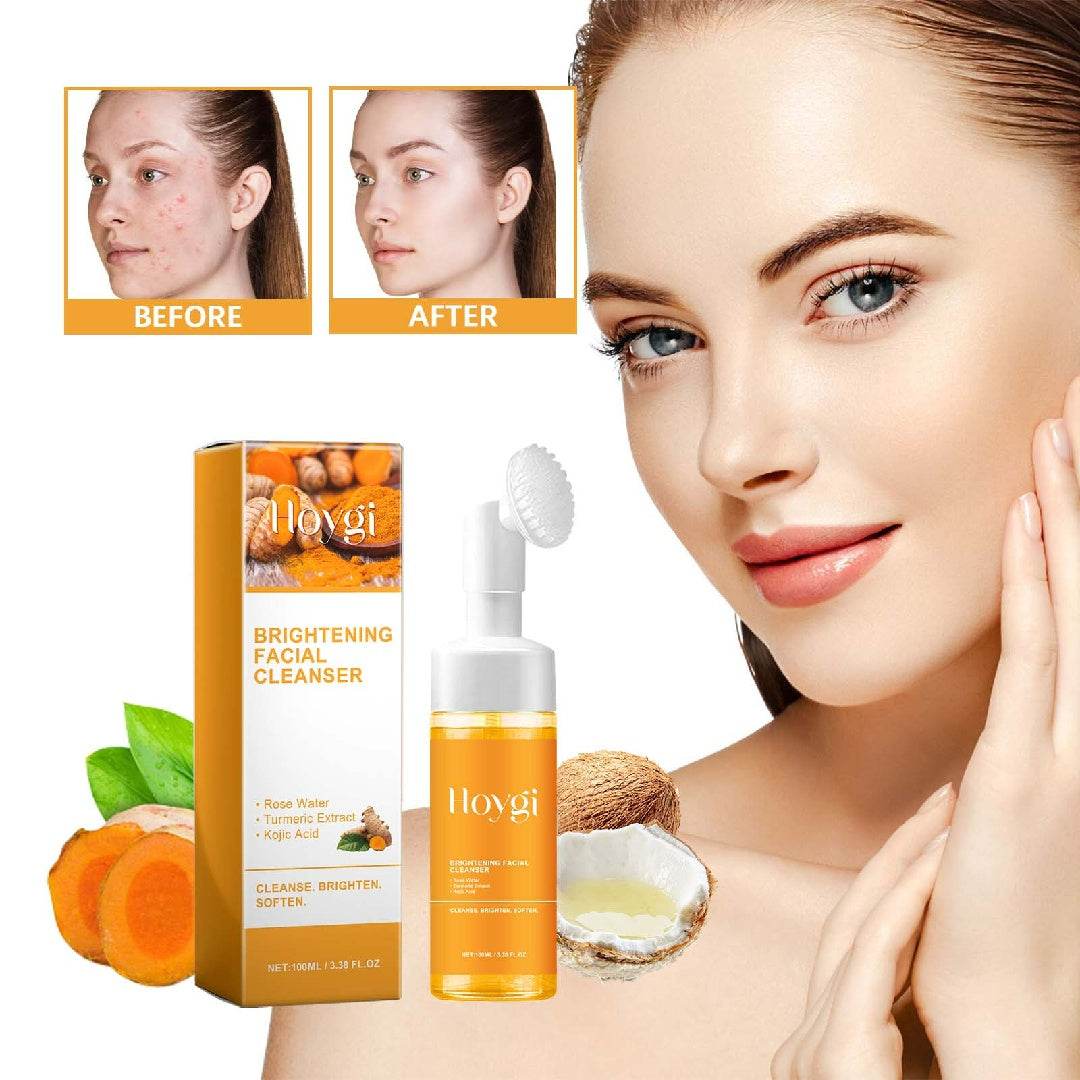 Hoygi Soin anti-taches acné naturel éclat et douceur - Bien-être & style 
