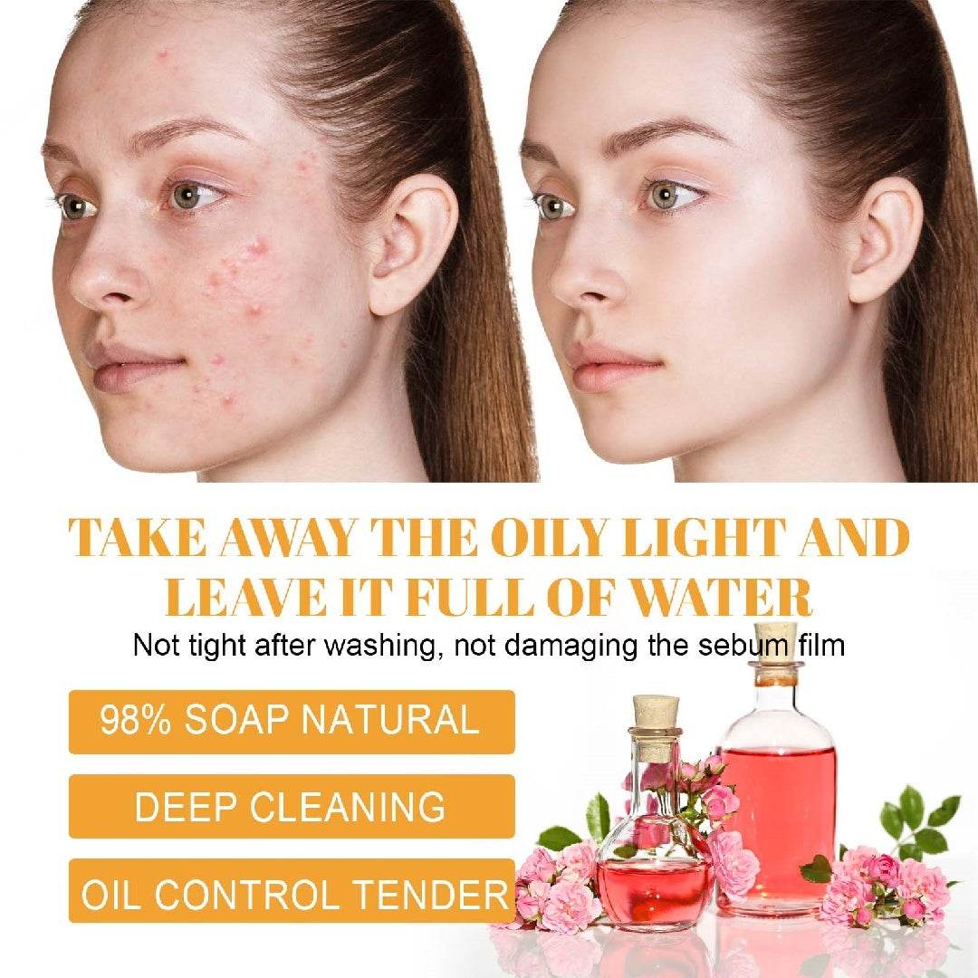Hoygi Soin anti-taches acné naturel éclat et douceur - Bien-être & style 