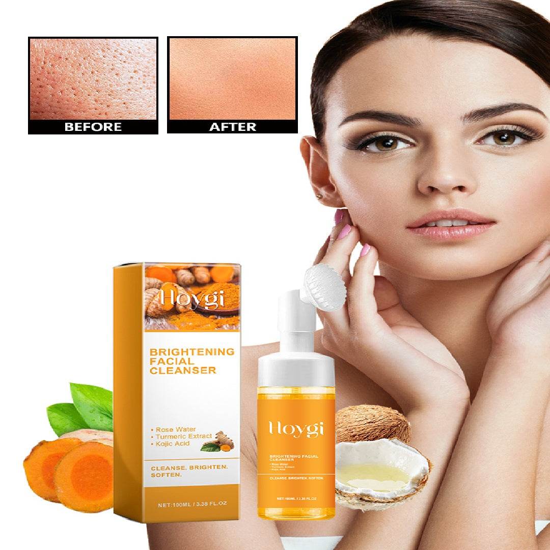 Hoygi Soin anti-taches acné naturel éclat et douceur - Bien-être & style 